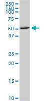 CDS1 Antibody - CDS1 monoclonal antibody (M01), clone 2D10. Western Blot analysis of CDS1 expression in human liver.