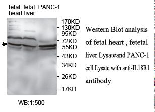 CDw218a / IL18R1 Antibody