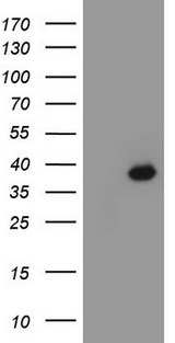 CDX2 Antibody - HEK293T cells were transfected with the pCMV6-ENTRY control (Left lane) or pCMV6-ENTRY CDX2 (Right lane) cDNA for 48 hrs and lysed. Equivalent amounts of cell lysates (5 ug per lane) were separated by SDS-PAGE and immunoblotted with anti-CDX2.
