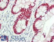 CDX2 Antibody - Human Small Intestine: Formalin-Fixed, Paraffin-Embedded (FFPE)