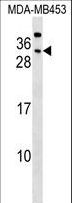 CEACAM7 Antibody - CEACAM7 Antibody western blot of MDA-MB453 cell line lysates (35 ug/lane). The CEACAM7 antibody detected the CEACAM7 protein (arrow).