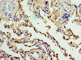 CEACAM8 / CD66b Antibody - Immunohistochemistry of paraffin-embedded human lung tissue using antibody at 1:100 dilution.