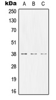CEACAM8 / CD66b Antibody - Western blot analysis of CD66b expression in MCF7 (A); NIH3T3 (B); PC12 (C) whole cell lysates.
