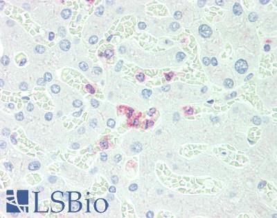CEACAM8 / CD66b Antibody - Human Liver, Neutrophils: Formalin-Fixed, Paraffin-Embedded (FFPE)