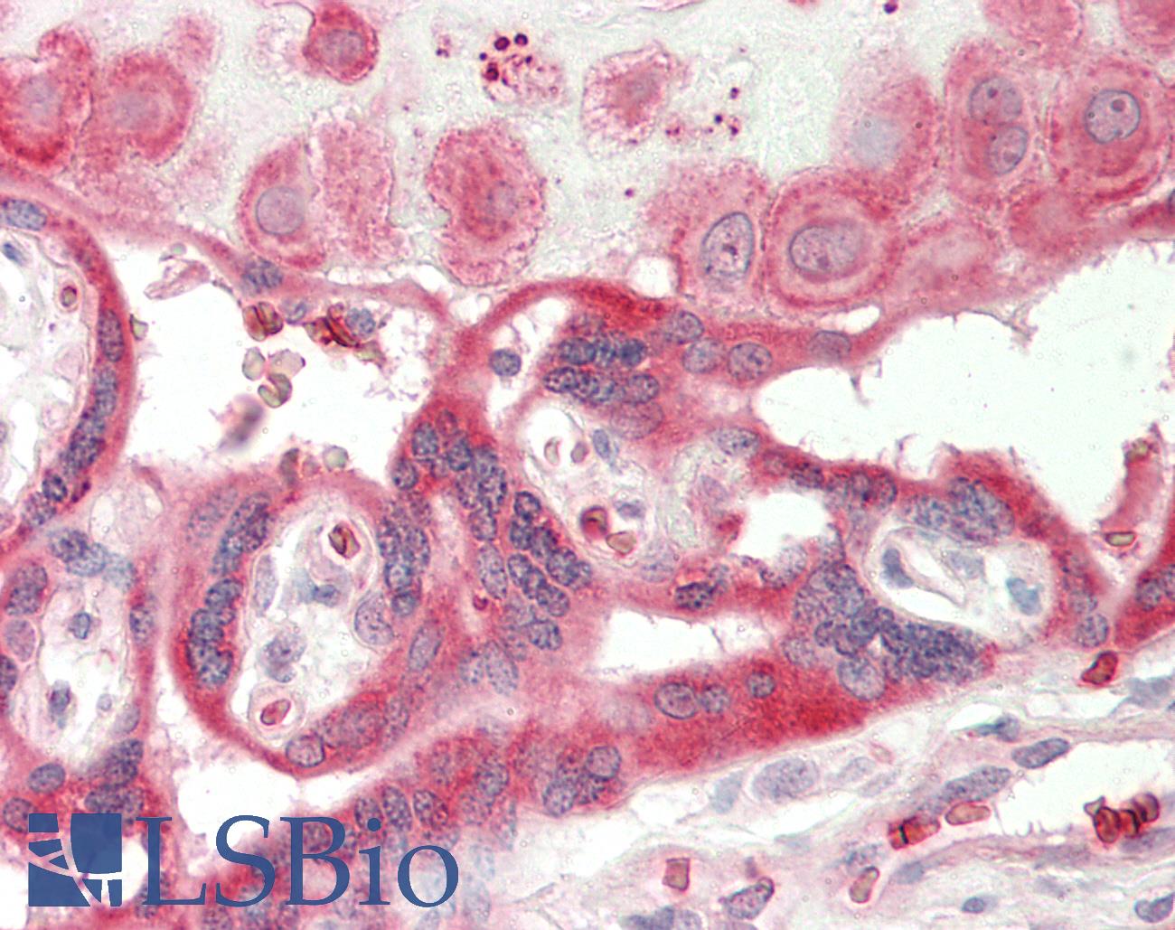 CECR1 Antibody - Human Placenta: Formalin-Fixed, Paraffin-Embedded (FFPE)