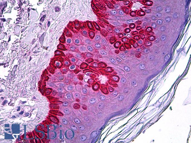 CELA1 / Pancreatic Elastase 1 Antibody - Anti-CELA1 antibody IHC of human skin. Immunohistochemistry of formalin-fixed, paraffin-embedded tissue after heat-induced antigen retrieval. Antibody concentration 5 ug/ml.