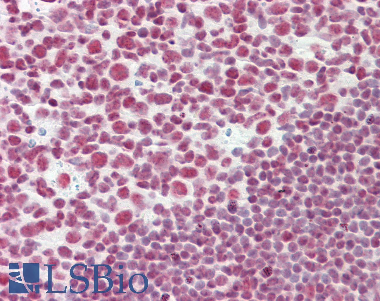 CELF2 / CUGBP2 Antibody - Anti-CELF2 / CUGBP2 antibody IHC staining of human tonsil. Immunohistochemistry of formalin-fixed, paraffin-embedded tissue after heat-induced antigen retrieval.