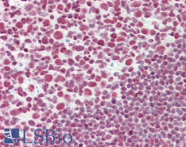 CELF2 / CUGBP2 Antibody - Anti-CELF2 / CUGBP2 antibody IHC staining of human tonsil. Immunohistochemistry of formalin-fixed, paraffin-embedded tissue after heat-induced antigen retrieval.