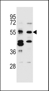 CELF3 Antibody - TNRC4 Antibody western blot of Jurkat,MDA-MB231 cell line lysates (35 ug/lane). The TNRC4 antibody detected the TNRC4 protein (arrow).