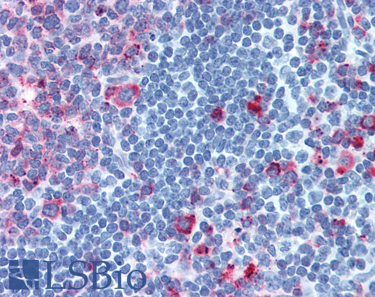 CELSR1 Antibody - Anti-CELSR1 antibody IHC of human tonsil. Immunohistochemistry of formalin-fixed, paraffin-embedded tissue after heat-induced antigen retrieval. Antibody concentration 8.4 ug/ml.