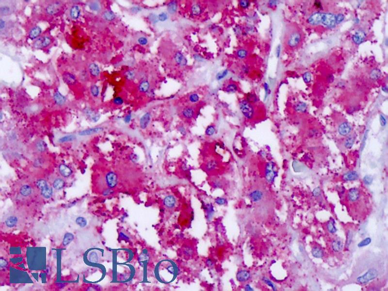 CELSR1 Antibody - Anti-CELSR1 antibody IHC of human adrenal. Immunohistochemistry of formalin-fixed, paraffin-embedded tissue after heat-induced antigen retrieval. Antibody concentration 8.4 ug/ml.