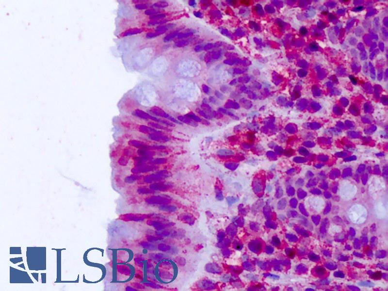 CELSR2 Antibody - Anti-CELSR2 antibody IHC of human colon, epithelium. Immunohistochemistry of formalin-fixed, paraffin-embedded tissue after heat-induced antigen retrieval. Antibody concentration 3-5 ug/ml.