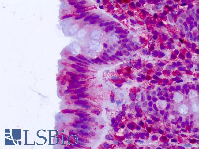 CELSR2 Antibody - Anti-CELSR2 antibody IHC of human colon, epithelium. Immunohistochemistry of formalin-fixed, paraffin-embedded tissue after heat-induced antigen retrieval. Antibody concentration 3-5 ug/ml.