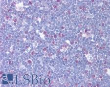 CENPF / CENP-F Antibody - Anti-CENPF antibody IHC of human thymus. Immunohistochemistry of formalin-fixed, paraffin-embedded tissue after heat-induced antigen retrieval. Antibody dilution 1:500. This image was taken for the unconjugated form of this product. Other forms have not been tested.