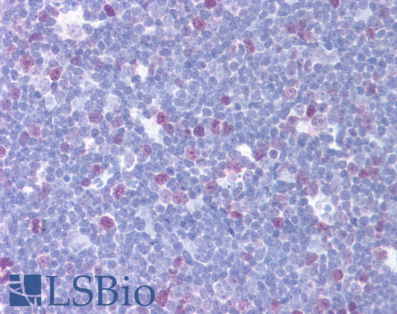 CENPF / CENP-F Antibody - Anti-CENPF antibody IHC of human thymus. Immunohistochemistry of formalin-fixed, paraffin-embedded tissue after heat-induced antigen retrieval. Antibody dilution 1:500. This image was taken for the unconjugated form of this product. Other forms have not been tested.