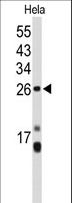 CENPH / CENP-H Antibody - Western blot of CENPH Antibody in HeLa cell line lysates (35 ug/lane). CENPH (arrow) was detected using the purified antibody.