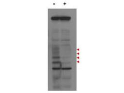 CENPU / MLF1IP Antibody - Anti-MLF1IP / PBIP1 Antibody - Western Blot. Western blot of affinity purified anti-MLF1IP / PBIP1 antibody shows detection of endogenous MLF1IP protein (a tier of four modified protein bands indicated by the arrowheads) in lysates of HeLa cells (- lane). Cells treated with MLF1IP / PBIP1 shRNA (+ lane) show no staining. The identities of the higher and lower molecular weight bands are unknown. Primary antibody was used at 1:1000. Personal Communication, K. S. Lee, NCI, Bethesda, MD.