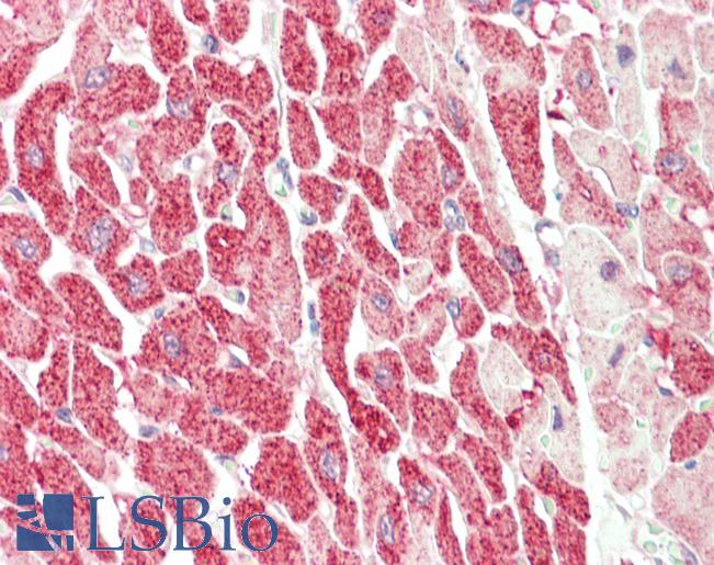CENPU / MLF1IP Antibody - Anti-CENPU / MLF1IP antibody IHC staining of human heart. Immunohistochemistry of formalin-fixed, paraffin-embedded tissue after heat-induced antigen retrieval.