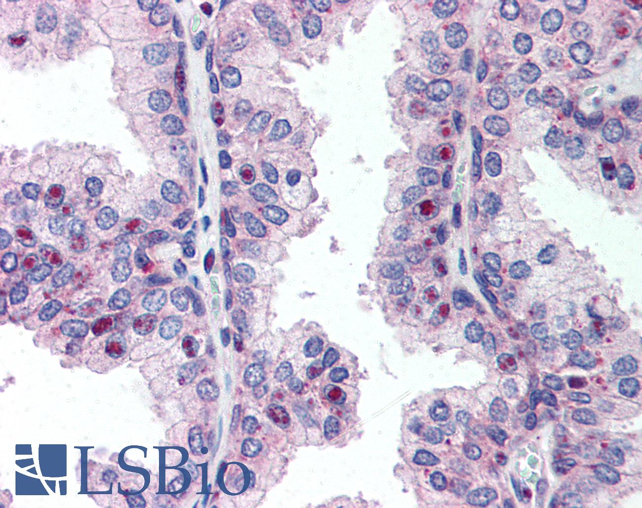 CENPU / MLF1IP Antibody - Anti-MLF1IP / PBIP1 antibody IHC of human prostate. Immunohistochemistry of formalin-fixed, paraffin-embedded tissue after heat-induced antigen retrieval. Antibody concentration 10 ug/ml.