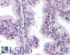 CENPU / MLF1IP Antibody - Anti-MLF1IP / PBIP1 antibody IHC of human prostate. Immunohistochemistry of formalin-fixed, paraffin-embedded tissue after heat-induced antigen retrieval. Antibody concentration 10 ug/ml.