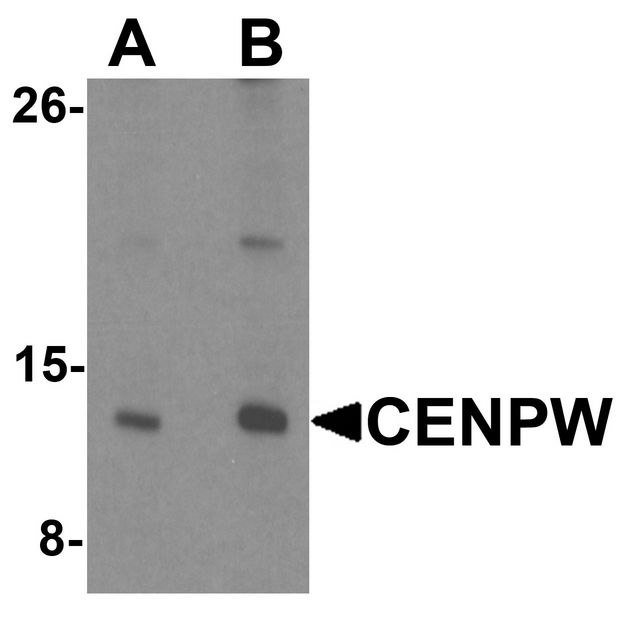 CENPW / C6orf173 Antibody - Western blot analysis of CENPW in HeLa cell lysate lysate with CENPW antibody at (A) 0.5 and (B) 1 ug/ml.
