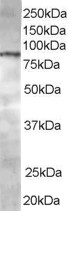 CENTB1 / ACAP1 Antibody - Antibody2 staining (0.5 ug/ml) of Jurkat lysate (RIPA buffer, 35 ug total protein per lane). Primary incubated for 1 hour. Detected by Western blot of chemiluminescence.
