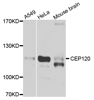 CEP120 Antibody - Western blot blot of extracts of various cell lines, using CEP120 antibody.