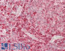 CEP120 Antibody - Human Tonsil: Formalin-Fixed, Paraffin-Embedded (FFPE)