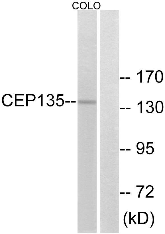 CEP135 Antibody - Western blot analysis of lysates from COLO cells, using CEP135 Antibody. The lane on the right is blocked with the synthesized peptide.