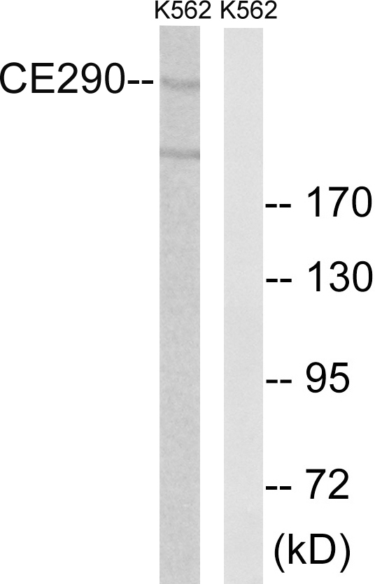 CEP290 Antibody - Western blot analysis of lysates from K562 cells, using CEP290 Antibody. The lane on the right is blocked with the synthesized peptide.