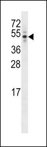 CEP44 / KIAA1712 Antibody - K1712 Antibody western blot of T47D cell line lysates (35 ug/lane). The K1712 Antibody detected the K1712 protein (arrow).