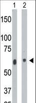 Ceramide Kinase / CERK Antibody - The anti-CERK antibody is used in Western blot to detect CERK in mouse heart tissue lysate (Lane 1) and A2058 cell lysate (Lane 2).