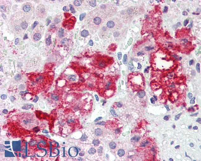 CerS6 / LASS6 Antibody - Anti-LASS6 antibody IHC of human adrenal. Immunohistochemistry of formalin-fixed, paraffin-embedded tissue after heat-induced antigen retrieval. Antibody concentration 5 ug/ml.