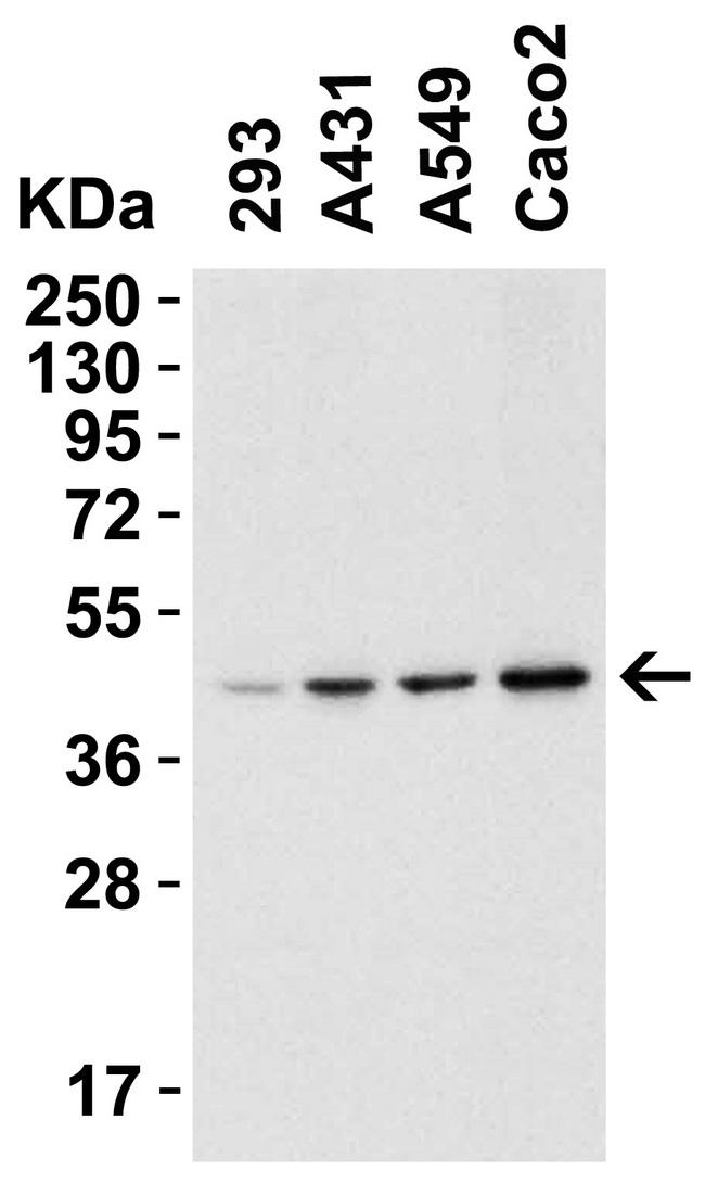 CerS6 / LASS6 Antibody - Western blot analysis of Anti-CERS6 antibody (LS-B3151, 1 µg/ml; 15 µg of lysate per lane). Lane 1: 293. Lane 2: A431 cell line. Lane 3: A549 cell line. Lane 4: Caco2 cell line. Antibody produced band at ~45 kDa 