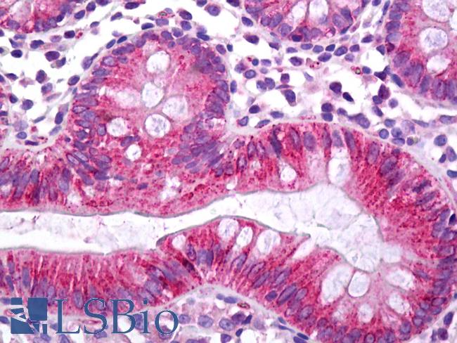 CES2 / Esterase Antibody - Anti-CES2 / Esterase antibody IHC of human colon. Immunohistochemistry of formalin-fixed, paraffin-embedded tissue after heat-induced antigen retrieval. Antibody concentration 5 ug/ml.