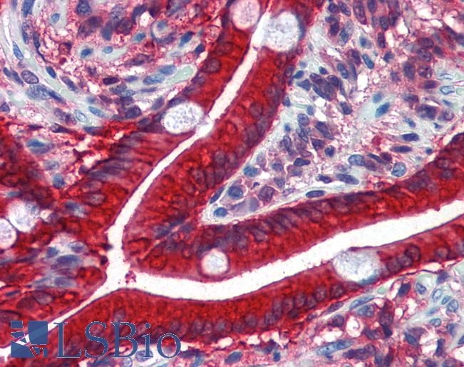CES2 / Esterase Antibody - Anti-CES2 / Esterase antibody IHC of human small intestine. Immunohistochemistry of formalin-fixed, paraffin-embedded tissue after heat-induced antigen retrieval. Antibody concentration 5 ug/ml.