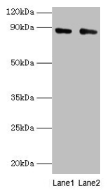 CFB / Complement Factor B Antibody - Western blot All lanes: Complement factor B antibody at 2µg/ml Lane 1: K562 whole cell lysate Lane 2: HepG2 whole cell lysate Secondary Goat polyclonal to rabbit IgG at 1/10000 dilution Predicted band size: 86, 69 kDa Observed band size: 86 kDa