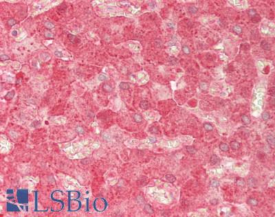 CFB / Complement Factor B Antibody - Human Liver: Formalin-Fixed, Paraffin-Embedded (FFPE)