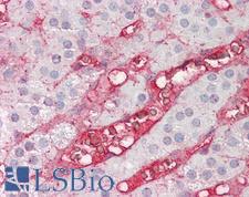 CFB / Complement Factor B Antibody - Anti-CFB / Factor B antibody IHC of human adrenal. Immunohistochemistry of formalin-fixed, paraffin-embedded tissue after heat-induced antigen retrieval. Antibody dilution 1:200.