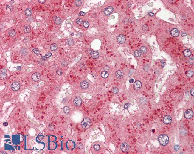 CFB / Complement Factor B Antibody - Anti-CFB / Factor B antibody IHC of human liver. Immunohistochemistry of formalin-fixed, paraffin-embedded tissue after heat-induced antigen retrieval. Antibody dilution 1:200.