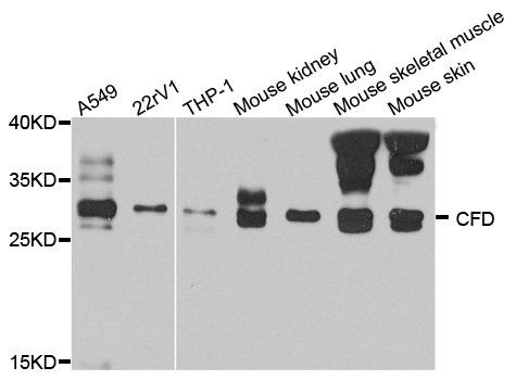 CFD / Factor D / Adipsin Antibody - Western blot analysis of extract of various cells.