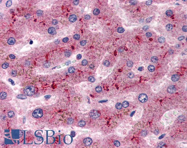 CFH / Complement Factor H Antibody - Anti-Factor H antibody IHC of human liver. Immunohistochemistry of formalin-fixed, paraffin-embedded tissue after heat-induced antigen retrieval. Antibody concentration 5 ug/ml.