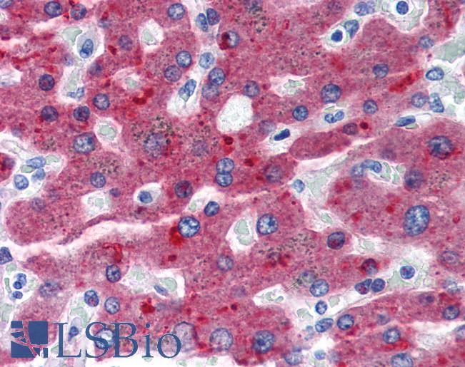 CFH / Complement Factor H Antibody - Anti-Factor H antibody IHC of human liver. Immunohistochemistry of formalin-fixed, paraffin-embedded tissue after heat-induced antigen retrieval. Antibody concentration 20 ug/ml.
