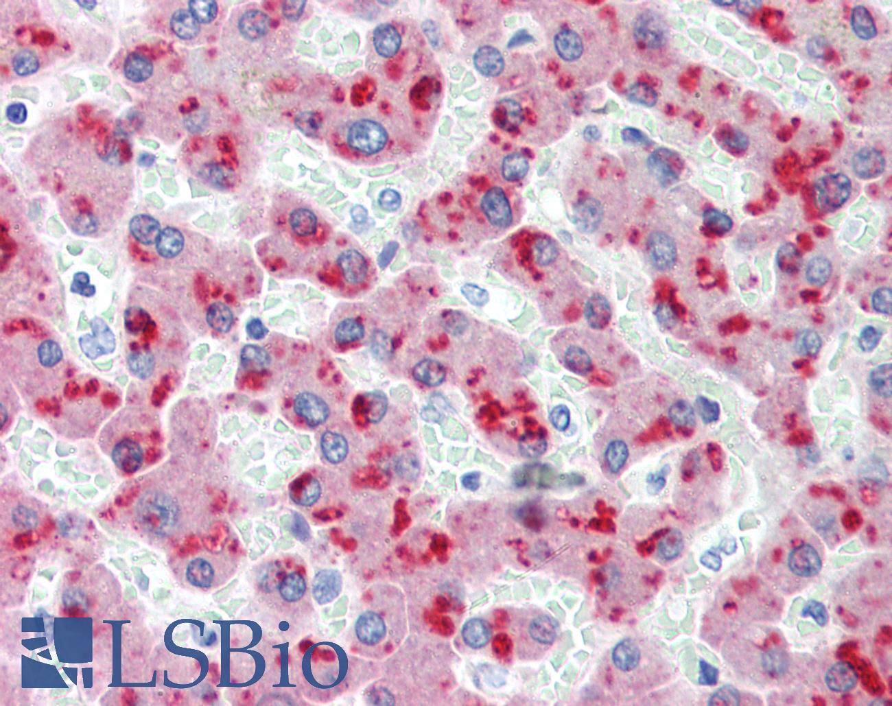 CFH / Complement Factor H Antibody - Anti-Factor H antibody IHC of human liver. Immunohistochemistry of formalin-fixed, paraffin-embedded tissue after heat-induced antigen retrieval. Antibody concentration 10 ug/ml.
