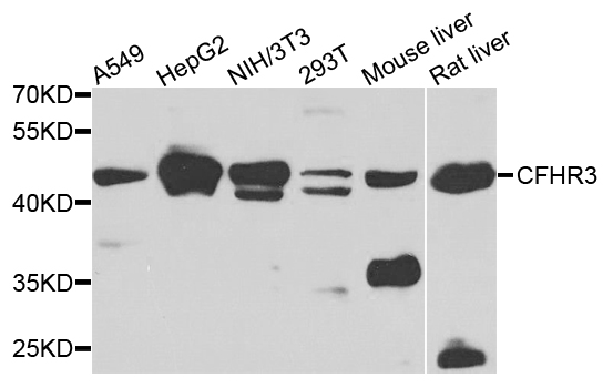 CFHR3 / CFHL3 Antibody - Western blot blot of extracts of various cells, using CFHR3 antibody.