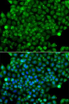 CFHR3 / CFHL3 Antibody - Immunofluorescence blot of A549 cell using CFHR3 antibody. Blue: DAPI for nuclear staining.