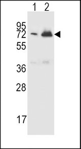 CFHR5 Antibody - CFHR5 Antibody western blot of CEM(lane 1),K562(lane 2) cell line lysates (15 ug/lane). The CFHR5 antibody detected the CFHR5 protein (arrow).