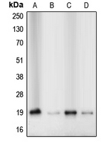 CFL1 / Cofilin Antibody - Western blot analysis of Cofilin expression in Jurkat (A); HeLa (B); MCF7 (C); A431 (D) whole cell lysates.