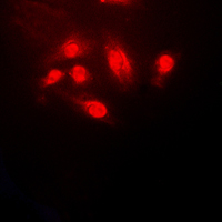 CFL1 / Cofilin Antibody - Immunofluorescent analysis of Cofilin staining in HeLa cells. Formalin-fixed cells were permeabilized with 0.1% Triton X-100 in TBS for 5-10 minutes and blocked with 3% BSA-PBS for 30 minutes at room temperature. Cells were probed with the primary antibody in 3% BSA-PBS and incubated overnight at 4 C in a humidified chamber. Cells were washed with PBST and incubated with a DyLight 594-conjugated secondary antibody (red) in PBS at room temperature in the dark. DAPI was used to stain the cell nuclei (blue).