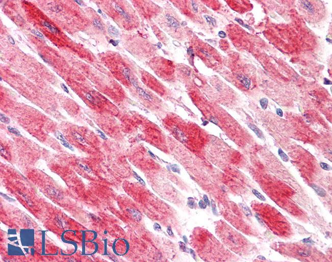 CFL2 / Cofilin 2 Antibody - Anti-CFL2 / Cofilin 2 antibody IHC staining of human heart. Immunohistochemistry of formalin-fixed, paraffin-embedded tissue after heat-induced antigen retrieval.